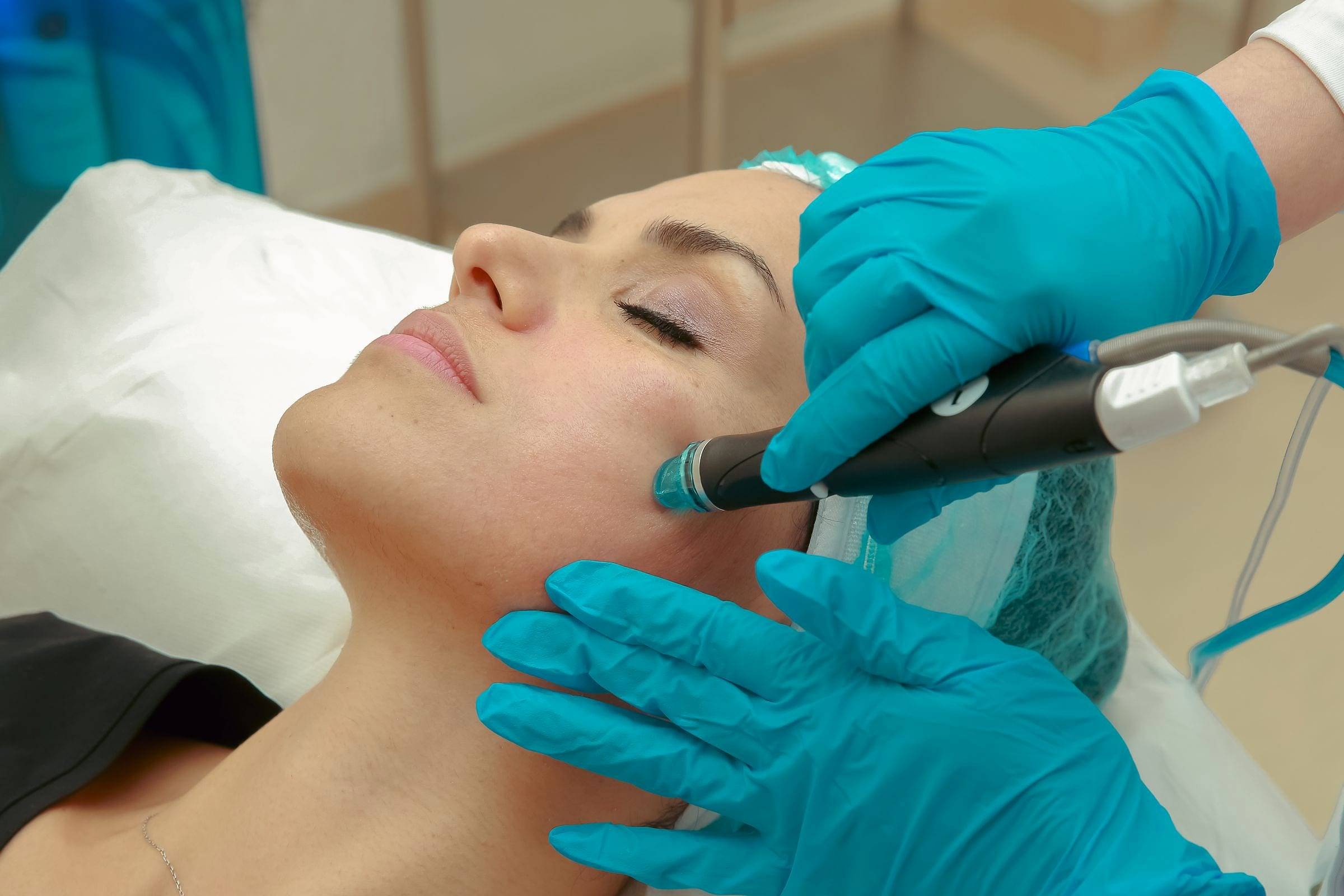Hidroterapia facial con cabezal de aspiración sobre la piel